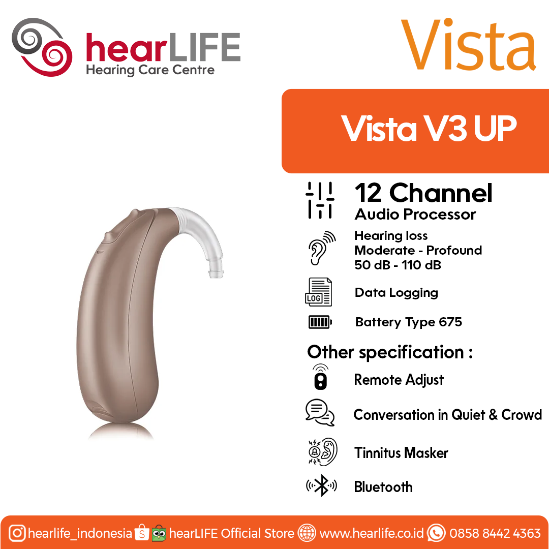 Vista V3 UP